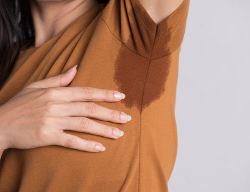 Suffer from excess sweating? You might have hyperhidrosis