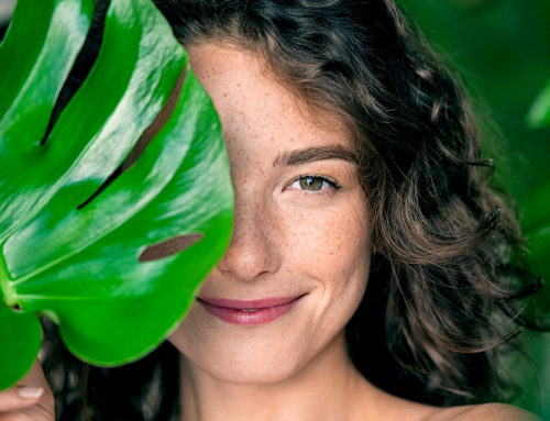 Freckles: Everything you need to know about these skin spots
